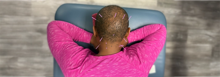 A person with dry needles in the back of their head