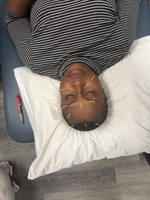 A person with dry needles in their face